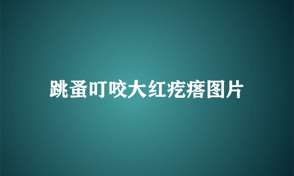 跳蚤叮咬大红疙瘩图片