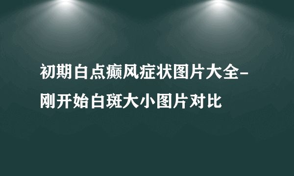 初期白点癫风症状图片大全-刚开始白斑大小图片对比