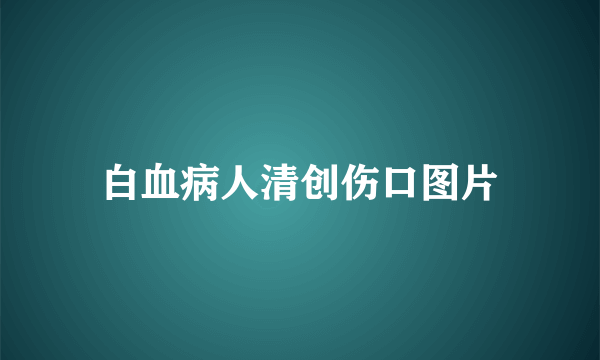 白血病人清创伤口图片