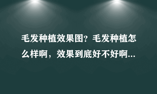 毛发种植效果图？毛发种植怎么样啊，效果到底好不好啊...