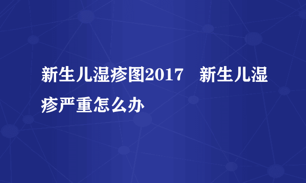 新生儿湿疹图2017   新生儿湿疹严重怎么办