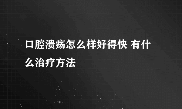 口腔溃疡怎么样好得快 有什么治疗方法