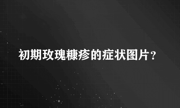 初期玫瑰糠疹的症状图片？