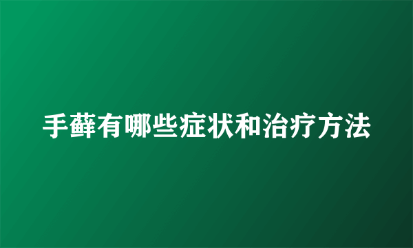 手藓有哪些症状和治疗方法