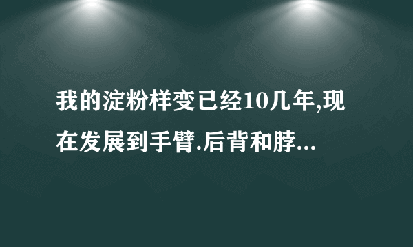 我的淀粉样变已经10几年,现在发展到手臂.后背和脖子.现皮质增厚,搔痒.