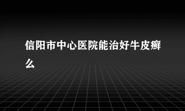 信阳市中心医院能治好牛皮癣么