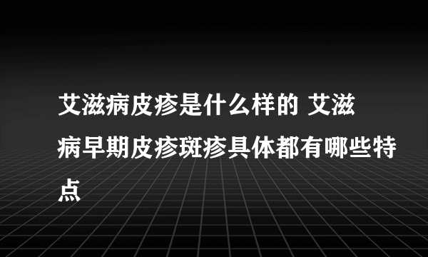 艾滋病皮疹是什么样的 艾滋病早期皮疹斑疹具体都有哪些特点