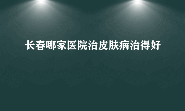 长春哪家医院治皮肤病治得好