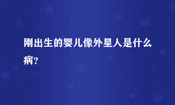 刚出生的婴儿像外星人是什么病？