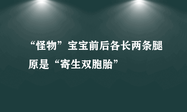 “怪物”宝宝前后各长两条腿 原是“寄生双胞胎”