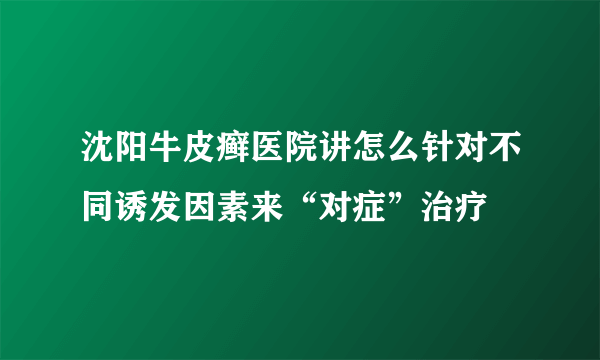 沈阳牛皮癣医院讲怎么针对不同诱发因素来“对症”治疗