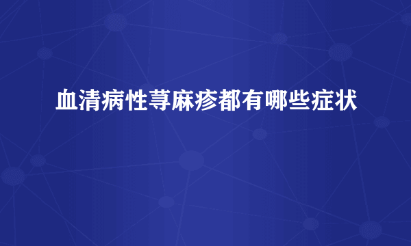 血清病性荨麻疹都有哪些症状