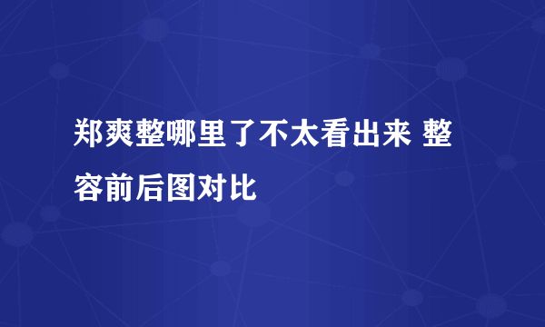 郑爽整哪里了不太看出来 整容前后图对比