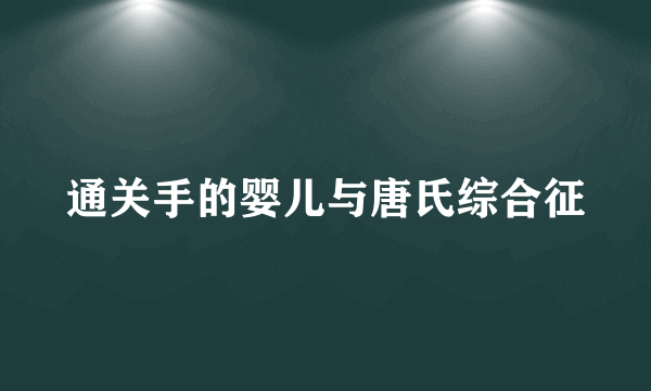 通关手的婴儿与唐氏综合征