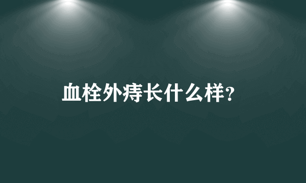 血栓外痔长什么样？