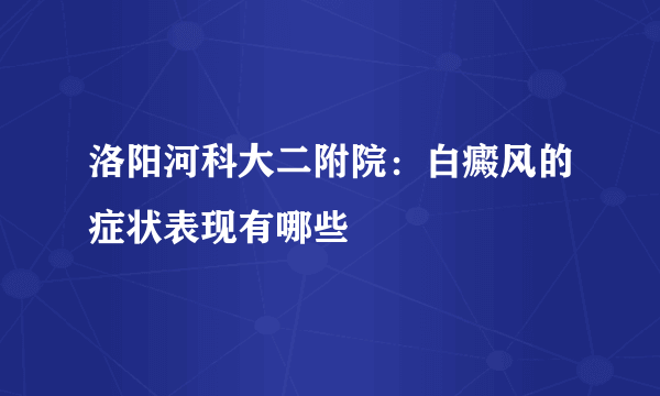 洛阳河科大二附院：白癜风的症状表现有哪些