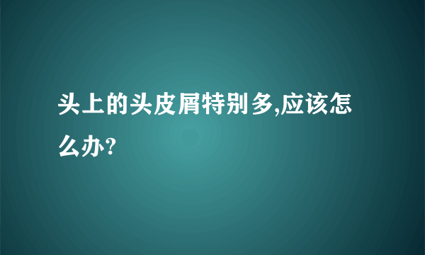 头上的头皮屑特别多,应该怎么办?