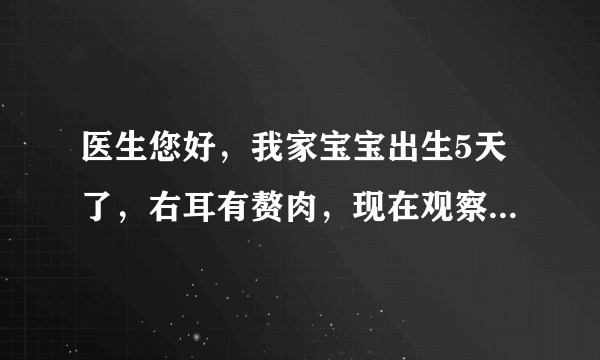 医生您好，我家宝宝出生5天了，右耳有赘肉，现在观察，右嘴角稍微有有点长，但不明显，目前未发现左右脸