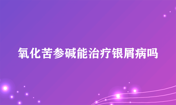 氧化苦参碱能治疗银屑病吗