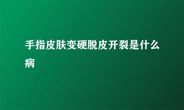 手指皮肤变硬脱皮开裂是什么病