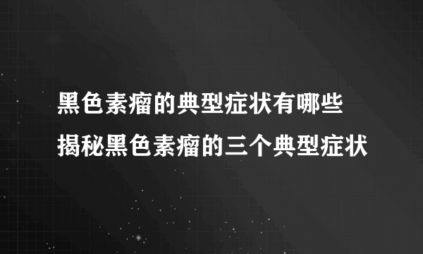 黑色素瘤的典型症状有哪些 揭秘黑色素瘤的三个典型症状