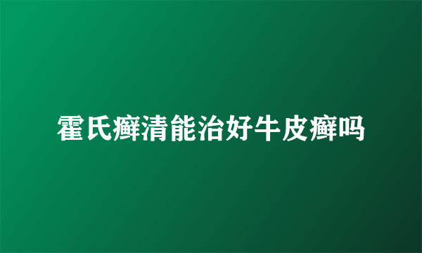 霍氏癣清能治好牛皮癣吗