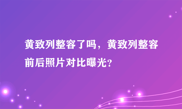 黄致列整容了吗，黄致列整容前后照片对比曝光？