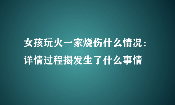 女孩玩火一家烧伤什么情况：详情过程揭发生了什么事情