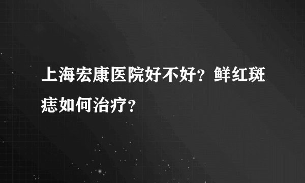 上海宏康医院好不好？鲜红斑痣如何治疗？