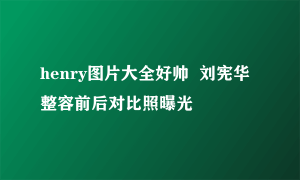 henry图片大全好帅  刘宪华整容前后对比照曝光