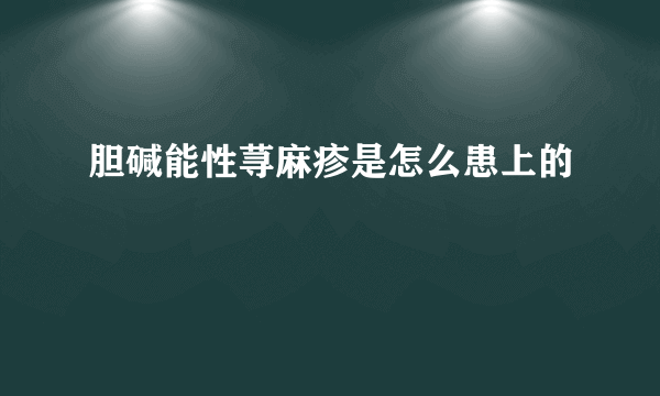 胆碱能性荨麻疹是怎么患上的