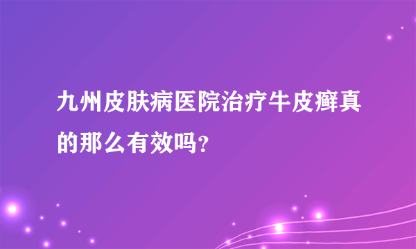 九州皮肤病医院治疗牛皮癣真的那么有效吗？