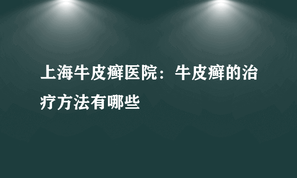 上海牛皮癣医院：牛皮癣的治疗方法有哪些