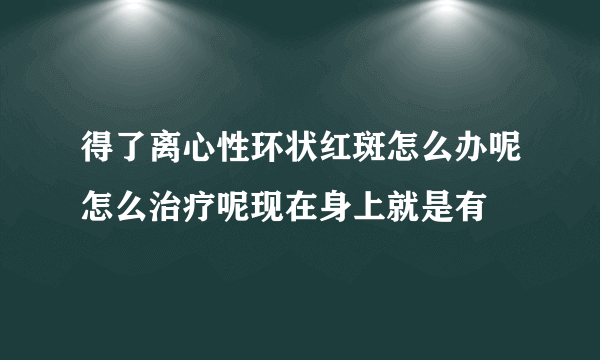 得了离心性环状红斑怎么办呢怎么治疗呢现在身上就是有