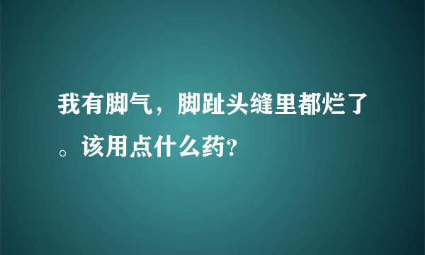 我有脚气，脚趾头缝里都烂了。该用点什么药？