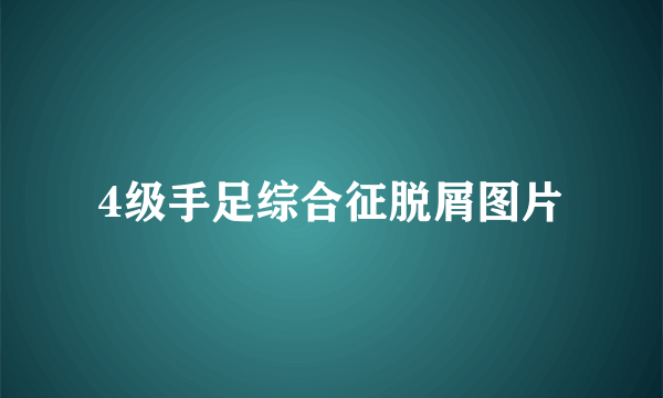 4级手足综合征脱屑图片