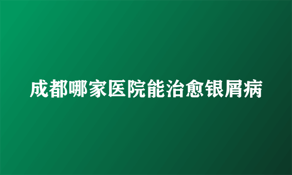 成都哪家医院能治愈银屑病