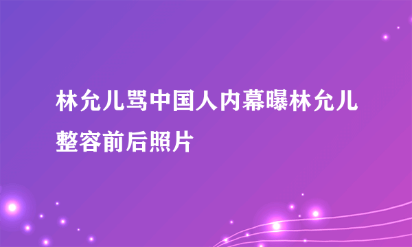 林允儿骂中国人内幕曝林允儿整容前后照片