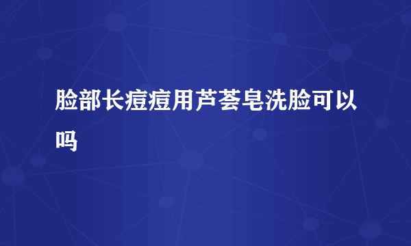 脸部长痘痘用芦荟皂洗脸可以吗