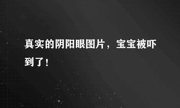 真实的阴阳眼图片，宝宝被吓到了！