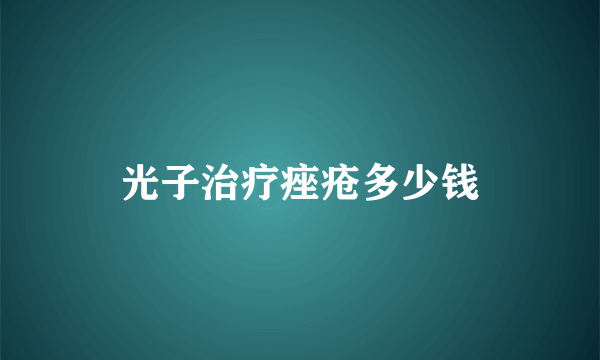 光子治疗痤疮多少钱