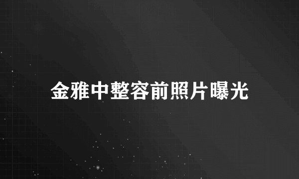 金雅中整容前照片曝光