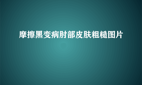 摩擦黑变病肘部皮肤粗糙图片