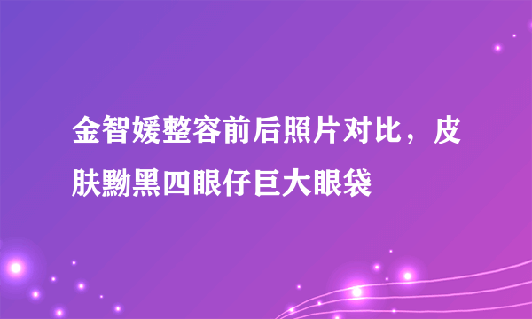 金智媛整容前后照片对比，皮肤黝黑四眼仔巨大眼袋 