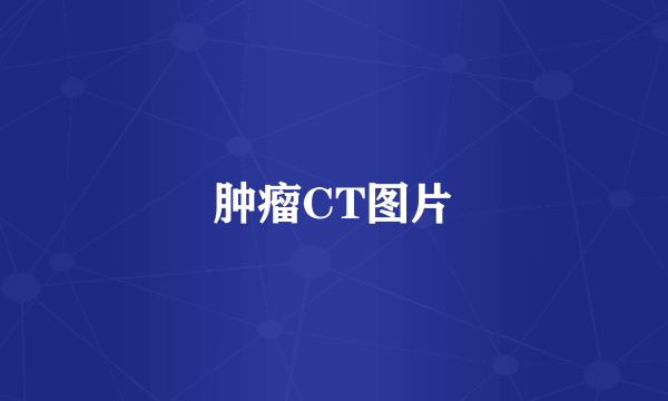 肿瘤CT图片