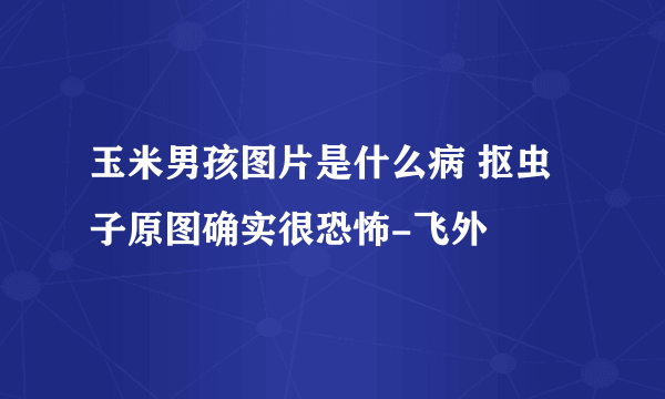 玉米男孩图片是什么病 抠虫子原图确实很恐怖-飞外